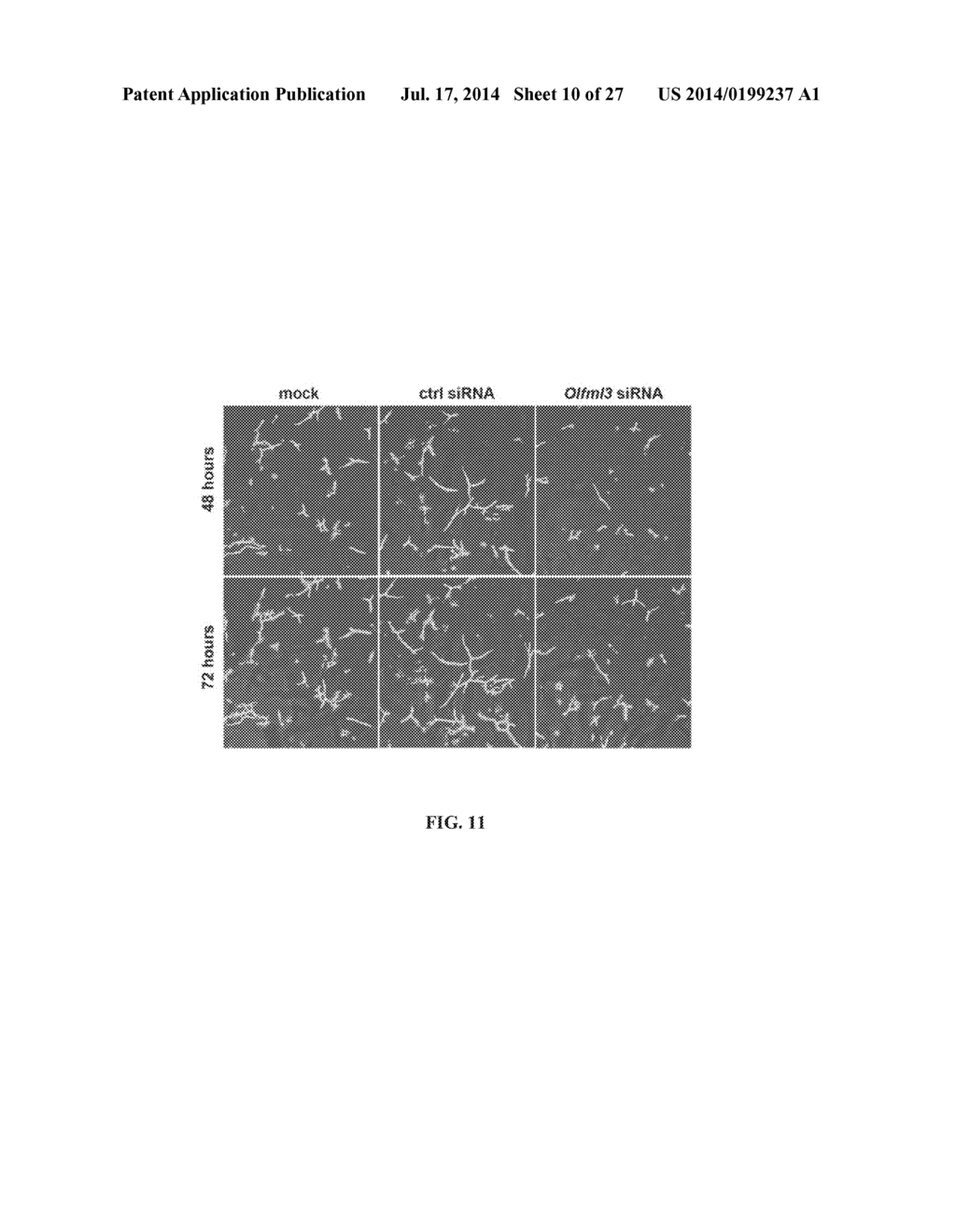 METHODS AND COMPOSITIONS FOR MODULATION OF OLFML3 MEDIATED ANGIOGENESIS - diagram, schematic, and image 11