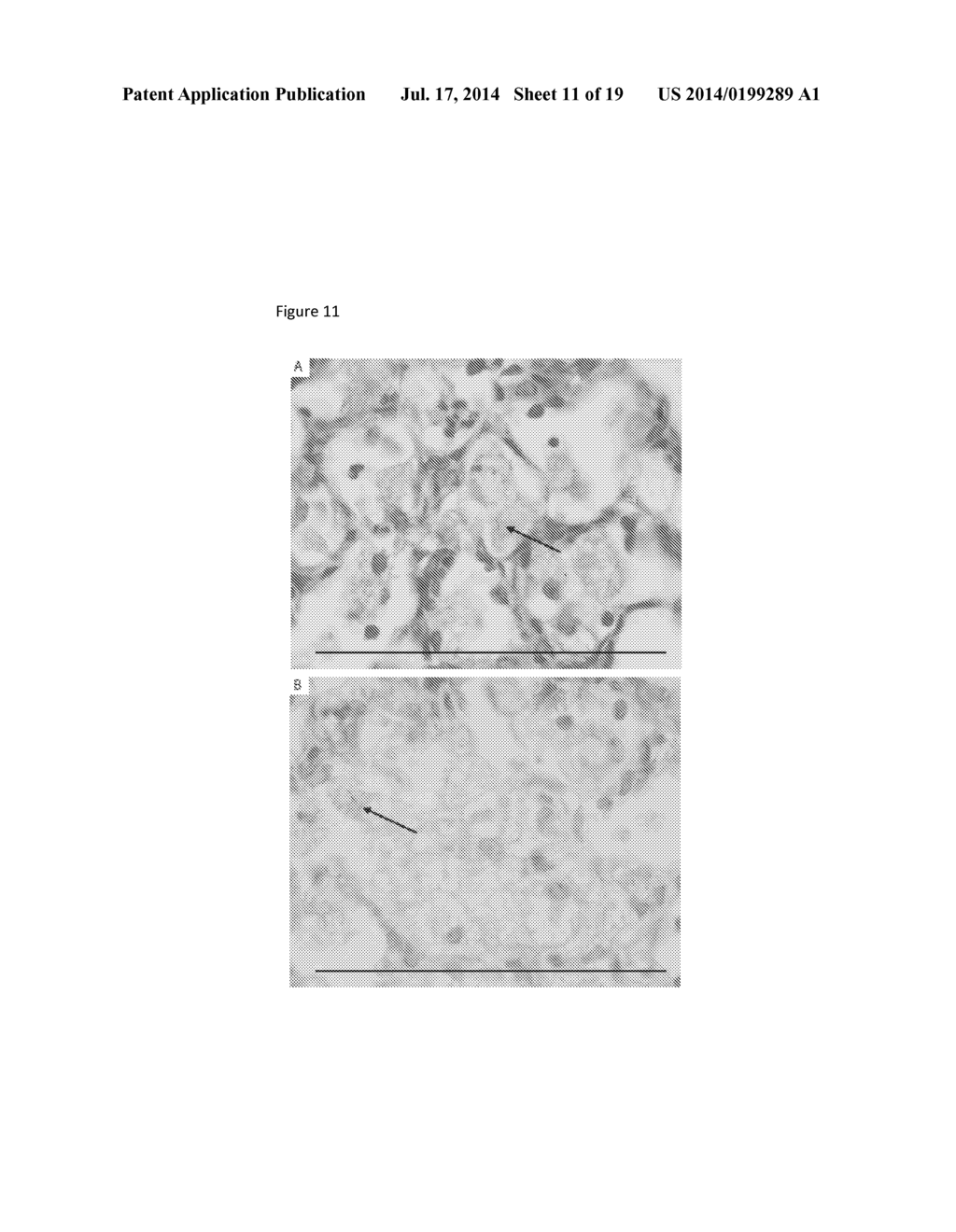 USE OF MATRIX METALLOPROTEINASE INHIBITORS TO TREAT TUBERCULOSIS - diagram, schematic, and image 12