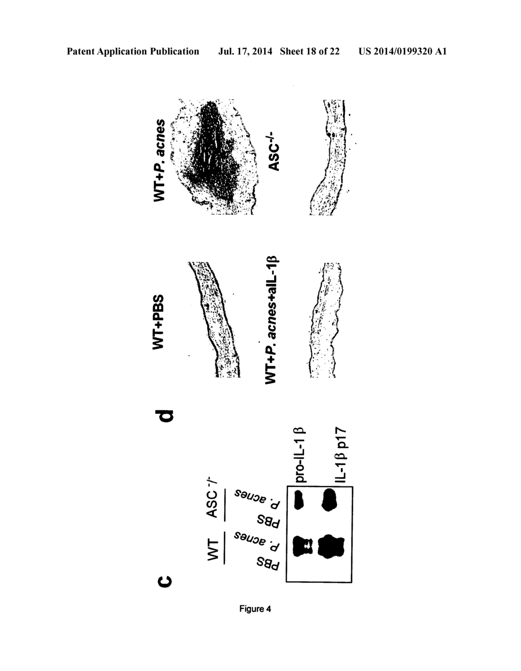 MODULATORS OF THE NLRP3 INFLAMMASOME IL-1BETA PATHWAY FOR THE PREVENTION     AND TREATMENT OF ACNE - diagram, schematic, and image 19