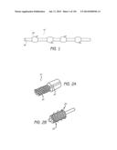 MINIMALLY INVASIVE BREAST LIFT METHOD WITH A SUPERIOR TISSUE SUPPORT AND     AN INFERIOR ANCHOR diagram and image