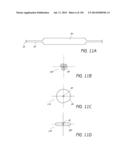 MINIMALLY INVASIVE BREAST LIFT METHOD WITH A SUPERIOR TISSUE SUPPORT AND     AN INFERIOR ANCHOR diagram and image