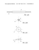 MINIMALLY INVASIVE BREAST LIFT METHOD WITH A SUPERIOR TISSUE SUPPORT AND     AN INFERIOR ANCHOR diagram and image