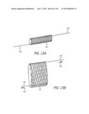 MINIMALLY INVASIVE BREAST LIFT METHOD WITH A SUPERIOR TISSUE SUPPORT AND     AN INFERIOR ANCHOR diagram and image