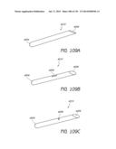 MINIMALLY INVASIVE BREAST LIFT METHOD WITH A SUPERIOR TISSUE SUPPORT AND     AN INFERIOR ANCHOR diagram and image