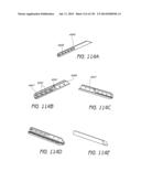 MINIMALLY INVASIVE BREAST LIFT METHOD WITH A SUPERIOR TISSUE SUPPORT AND     AN INFERIOR ANCHOR diagram and image