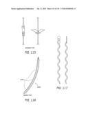 MINIMALLY INVASIVE BREAST LIFT METHOD WITH A SUPERIOR TISSUE SUPPORT AND     AN INFERIOR ANCHOR diagram and image