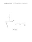 MINIMALLY INVASIVE BREAST LIFT METHOD WITH A SUPERIOR TISSUE SUPPORT AND     AN INFERIOR ANCHOR diagram and image