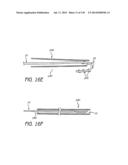 MINIMALLY INVASIVE BREAST LIFT METHOD WITH A SUPERIOR TISSUE SUPPORT AND     AN INFERIOR ANCHOR diagram and image