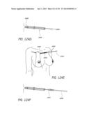 MINIMALLY INVASIVE BREAST LIFT METHOD WITH A SUPERIOR TISSUE SUPPORT AND     AN INFERIOR ANCHOR diagram and image