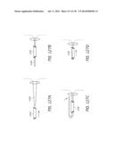 MINIMALLY INVASIVE BREAST LIFT METHOD WITH A SUPERIOR TISSUE SUPPORT AND     AN INFERIOR ANCHOR diagram and image