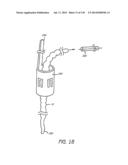 MINIMALLY INVASIVE BREAST LIFT METHOD WITH A SUPERIOR TISSUE SUPPORT AND     AN INFERIOR ANCHOR diagram and image