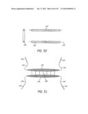 MINIMALLY INVASIVE BREAST LIFT METHOD WITH A SUPERIOR TISSUE SUPPORT AND     AN INFERIOR ANCHOR diagram and image