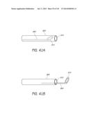 MINIMALLY INVASIVE BREAST LIFT METHOD WITH A SUPERIOR TISSUE SUPPORT AND     AN INFERIOR ANCHOR diagram and image