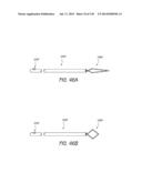 MINIMALLY INVASIVE BREAST LIFT METHOD WITH A SUPERIOR TISSUE SUPPORT AND     AN INFERIOR ANCHOR diagram and image