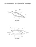 MINIMALLY INVASIVE BREAST LIFT METHOD WITH A SUPERIOR TISSUE SUPPORT AND     AN INFERIOR ANCHOR diagram and image