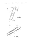 MINIMALLY INVASIVE BREAST LIFT METHOD WITH A SUPERIOR TISSUE SUPPORT AND     AN INFERIOR ANCHOR diagram and image