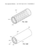 MINIMALLY INVASIVE BREAST LIFT METHOD WITH A SUPERIOR TISSUE SUPPORT AND     AN INFERIOR ANCHOR diagram and image