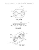 MINIMALLY INVASIVE BREAST LIFT METHOD WITH A SUPERIOR TISSUE SUPPORT AND     AN INFERIOR ANCHOR diagram and image