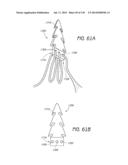 MINIMALLY INVASIVE BREAST LIFT METHOD WITH A SUPERIOR TISSUE SUPPORT AND     AN INFERIOR ANCHOR diagram and image