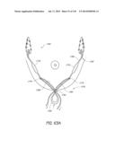 MINIMALLY INVASIVE BREAST LIFT METHOD WITH A SUPERIOR TISSUE SUPPORT AND     AN INFERIOR ANCHOR diagram and image