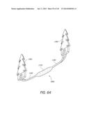 MINIMALLY INVASIVE BREAST LIFT METHOD WITH A SUPERIOR TISSUE SUPPORT AND     AN INFERIOR ANCHOR diagram and image