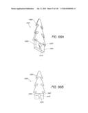 MINIMALLY INVASIVE BREAST LIFT METHOD WITH A SUPERIOR TISSUE SUPPORT AND     AN INFERIOR ANCHOR diagram and image