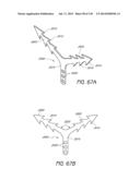 MINIMALLY INVASIVE BREAST LIFT METHOD WITH A SUPERIOR TISSUE SUPPORT AND     AN INFERIOR ANCHOR diagram and image