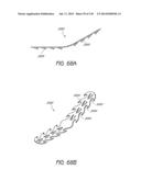 MINIMALLY INVASIVE BREAST LIFT METHOD WITH A SUPERIOR TISSUE SUPPORT AND     AN INFERIOR ANCHOR diagram and image