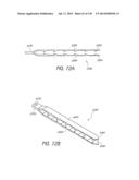 MINIMALLY INVASIVE BREAST LIFT METHOD WITH A SUPERIOR TISSUE SUPPORT AND     AN INFERIOR ANCHOR diagram and image