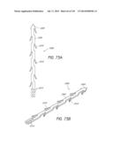 MINIMALLY INVASIVE BREAST LIFT METHOD WITH A SUPERIOR TISSUE SUPPORT AND     AN INFERIOR ANCHOR diagram and image