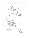 MINIMALLY INVASIVE BREAST LIFT METHOD WITH A SUPERIOR TISSUE SUPPORT AND     AN INFERIOR ANCHOR diagram and image