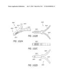 MINIMALLY INVASIVE BREAST LIFT METHOD WITH A SUPERIOR TISSUE SUPPORT AND     AN INFERIOR ANCHOR diagram and image