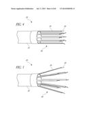 DIVERTICULUM INVERTING DEVICE diagram and image