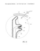 DIVERTICULUM INVERTING DEVICE diagram and image