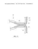 DIVERTICULUM INVERTING DEVICE diagram and image