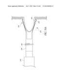 DIVERTICULUM INVERTING DEVICE diagram and image