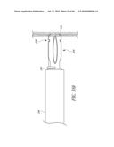 DIVERTICULUM INVERTING DEVICE diagram and image