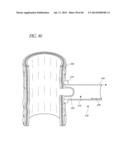 DIVERTICULUM INVERTING DEVICE diagram and image