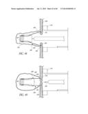 DIVERTICULUM INVERTING DEVICE diagram and image