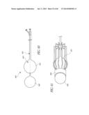 DIVERTICULUM INVERTING DEVICE diagram and image