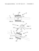 POSITIONAL STABILIZATION AND SECUREMENT COUPLING ATTACHMENT FOR USE IN     LAPAROSCOPIC SURGERY AND METHOD OF USE diagram and image