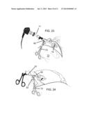 POSITIONAL STABILIZATION AND SECUREMENT COUPLING ATTACHMENT FOR USE IN     LAPAROSCOPIC SURGERY AND METHOD OF USE diagram and image