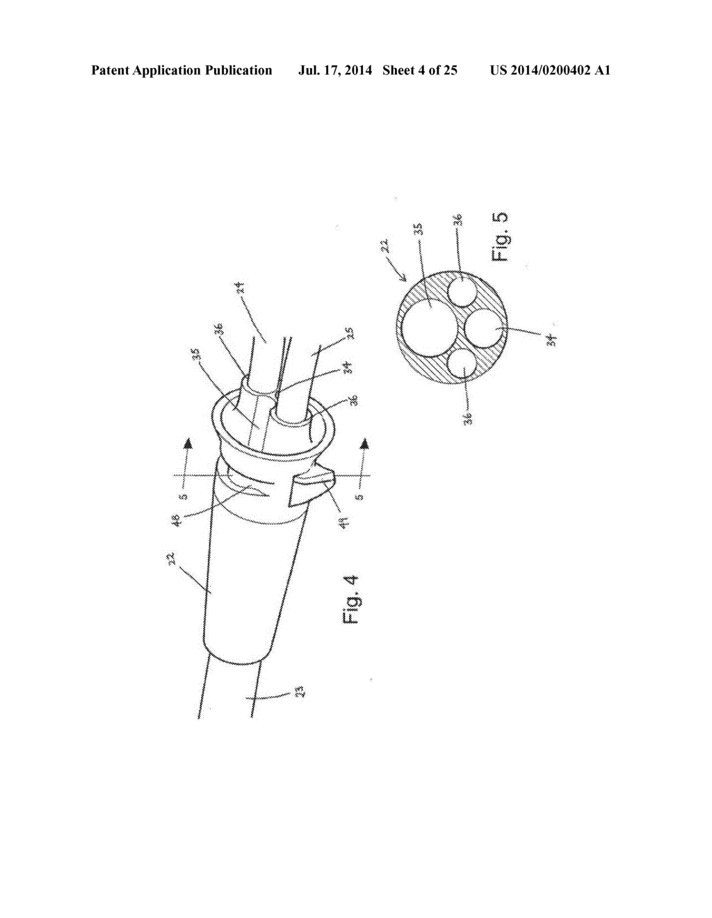 Medical Device Introduction Systems and Methods - diagram, schematic, and image 05