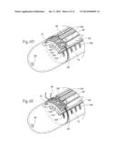 SYSTEMS AND METHODS FOR TREATING DYSFUNCTIONS IN THE INTESTINES AND RECTUM     THAT ADAPT TO THE ANATOMIC FORM AND STRUCTURE OF DIFFERENT INDIVIDUALS diagram and image