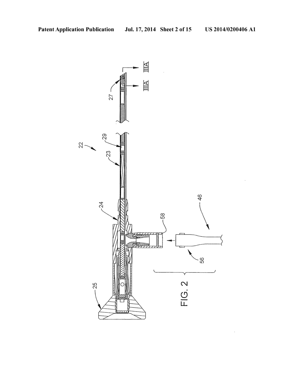 ANTI-FOGGING DEVICE FOR ENDOSCOPE - diagram, schematic, and image 03