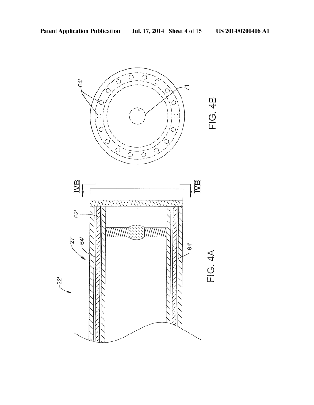 ANTI-FOGGING DEVICE FOR ENDOSCOPE - diagram, schematic, and image 05