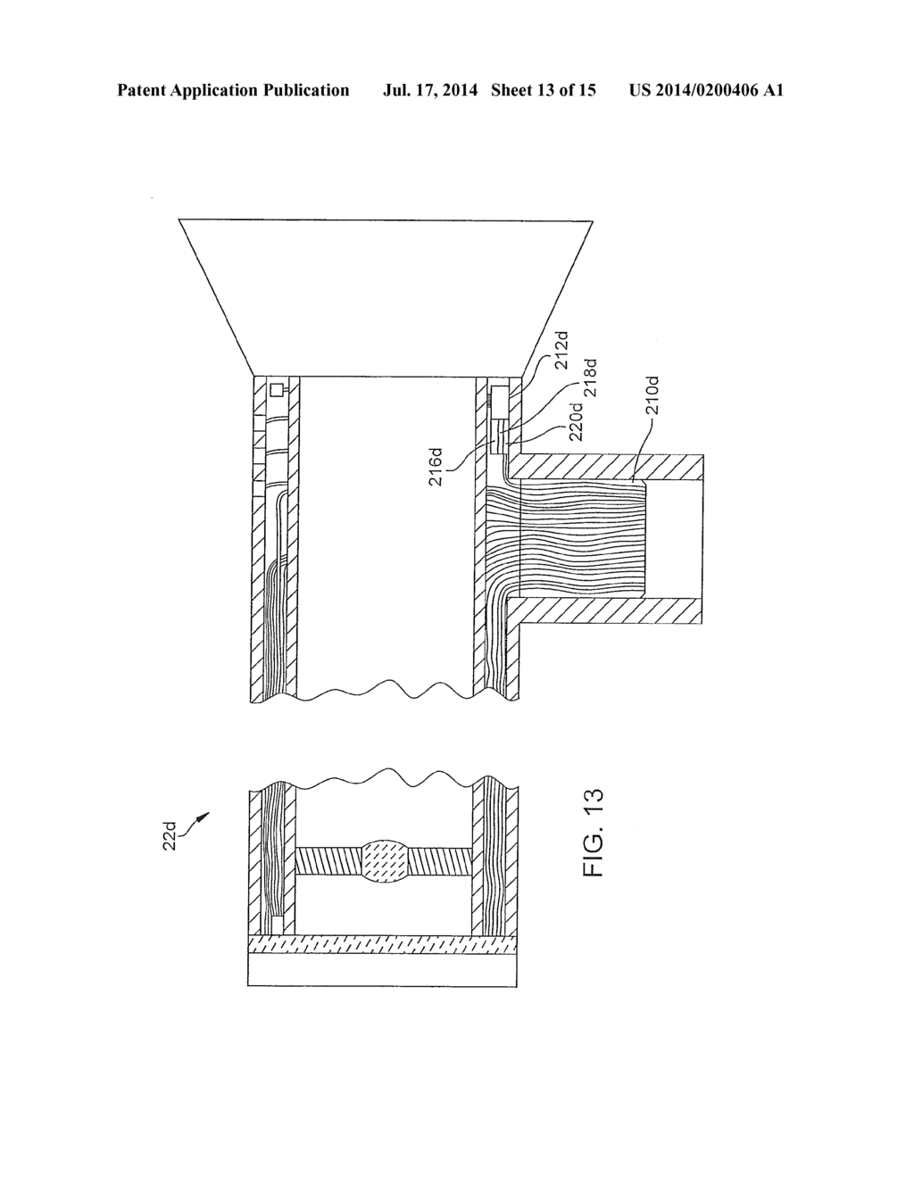 ANTI-FOGGING DEVICE FOR ENDOSCOPE - diagram, schematic, and image 14