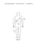 SYSTEM FOR CALIBRATING A PTT-BASED BLOOD PRESSURE MEASUREMENT USING ARM     HEIGHT diagram and image