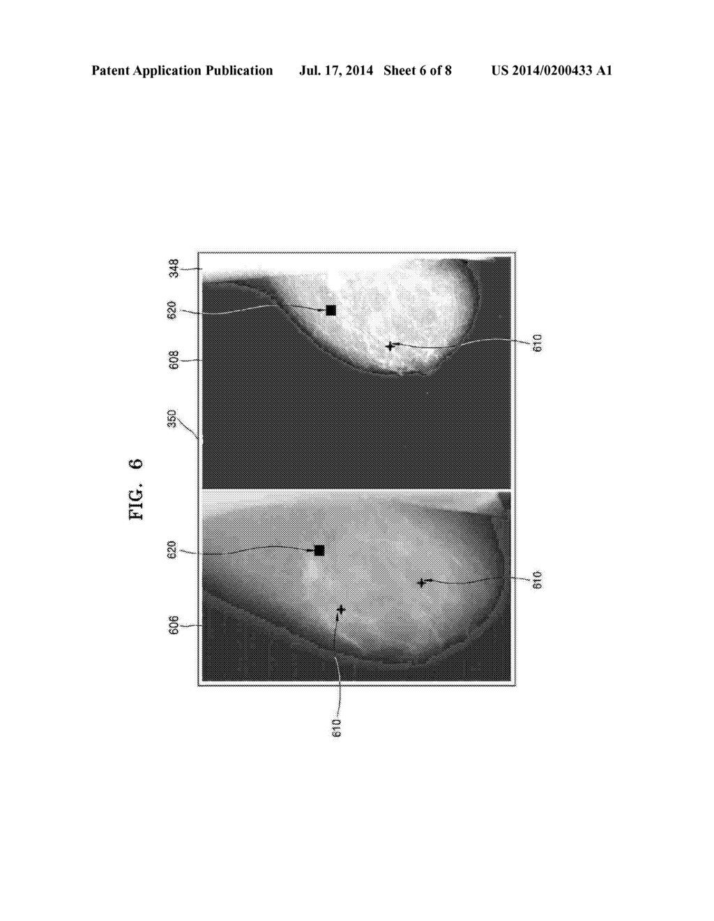 APPARATUS AND METHOD FOR ESTIMATING MALIGNANT TUMOR - diagram, schematic, and image 07