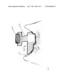 METHODS OF ORIENTING AND REGISTERING DURING A SURGICAL PROCEDURE diagram and image